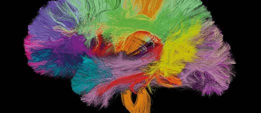 Visuel des principaux faisceaux de fibres du cerveau vus par un IRM